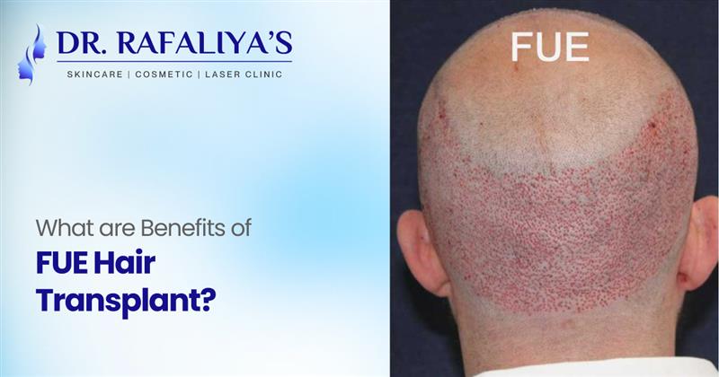Hair Transplant