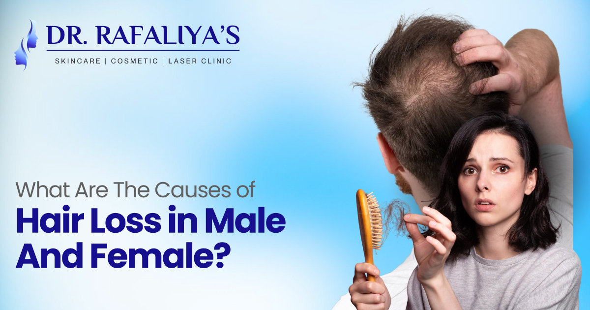 Hair Loss in males and females