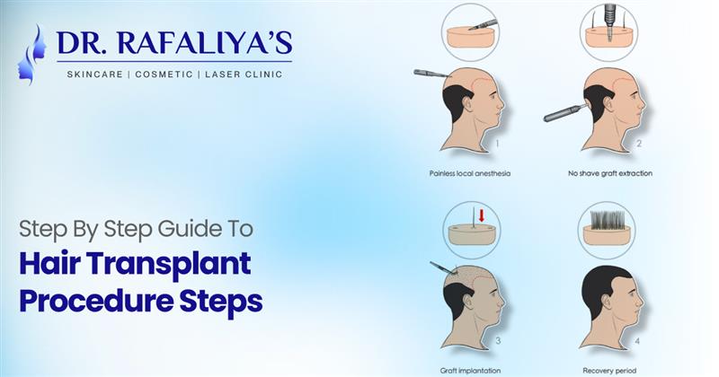 Hair Transplant