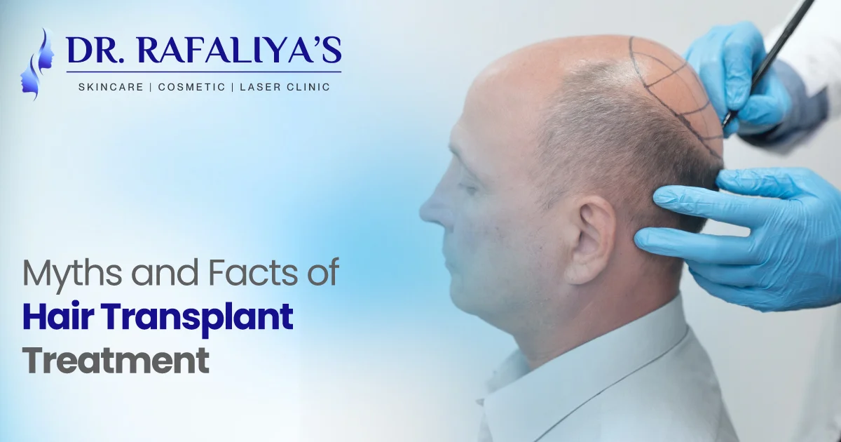 myths and facts of hair transplant treatment